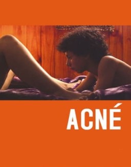 ver Acné